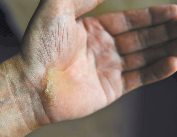 龙泉山“最美村医” 独腿行走崎岖山路三十载5