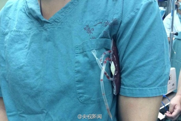 08抢救现场。