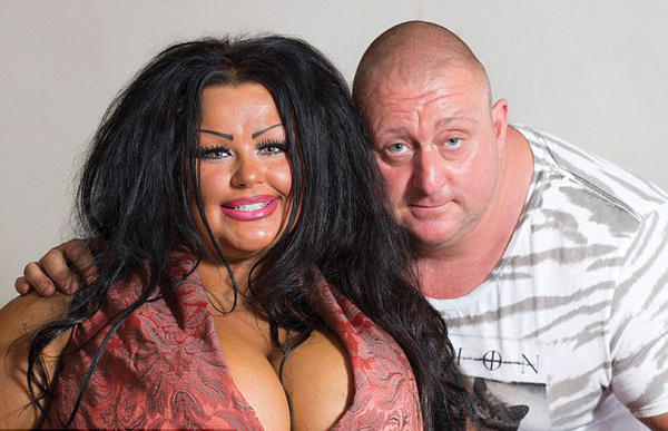 她做过的手术包括5次隆胸术、唇部注射、肉毒杆菌注射、牙齿美白、和半永久性妆容等。