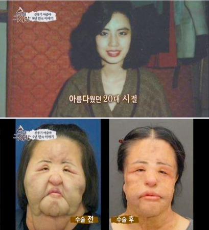 美女整容上瘾-手术失败变电风扇大妈2