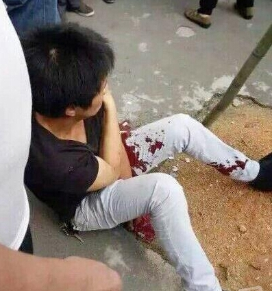 湖南银行门口枪击事件-一押款员开枪打伤青年3