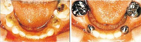 U481P4T8D7429253F107DT20150727105550 U481P4T8D7429253F107DT20150727105550