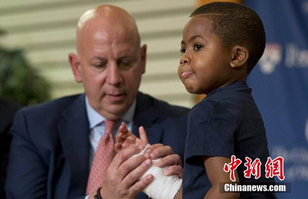 美国8岁男孩成功移植双手-为年龄最小案例4