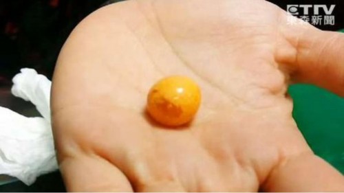 椰子螺吐出美乐珠，图为老板娘捡到的美乐珠