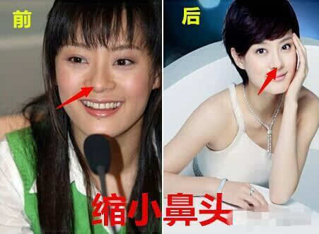 孙俪被导演赞用生命演戏，这次孙俪自曝整过容，这算不算也是用生命在演戏？1