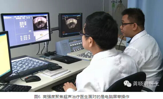 龚晓明：1/3女性都有的子宫肌瘤到底是啥