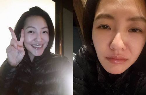 小S晒“臭脸”照称已便秘两天网友热情提供对策