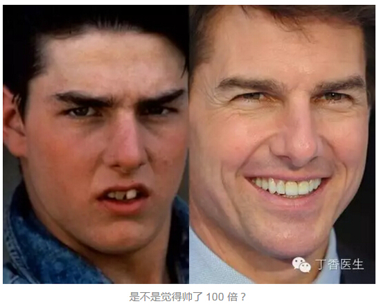 明星变美都说是因为矫正了牙齿可能吗？