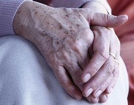 别把皮肤癌误当老年斑 当心要命