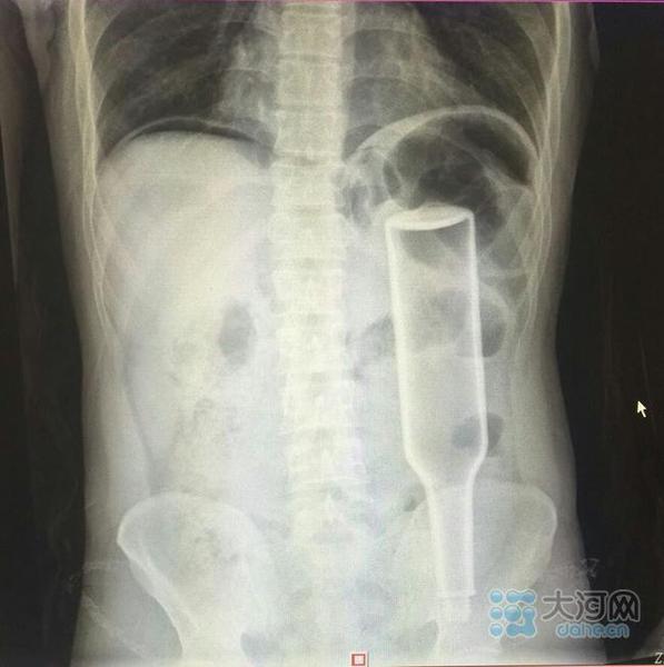 点击进入下一页