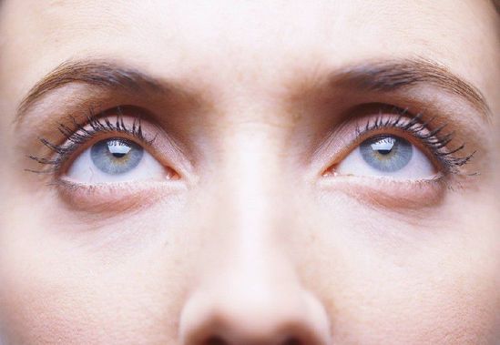 眼袋不是卧蚕！认清关于眼袋的五大误区