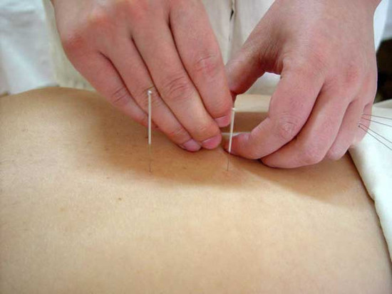 针灸时如果发生晕针怎么办？