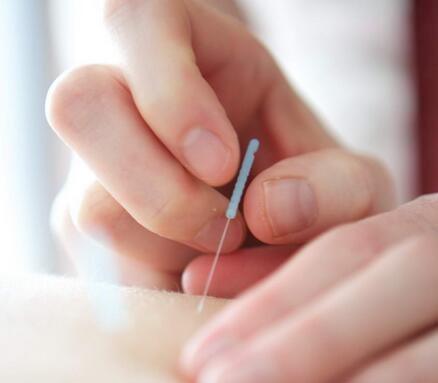针灸治病好 但七类人针灸须注意