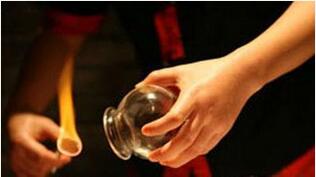 夏天拔罐效果最好 祛湿又能除顽疾！