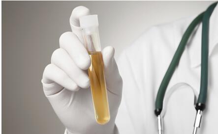 内脏好不好 教你先看早起第一泡尿