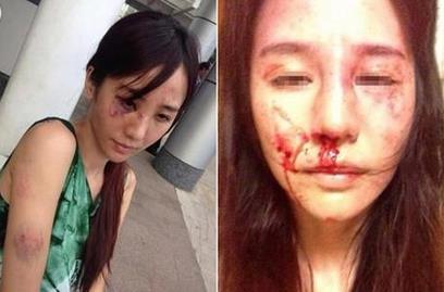 合肥女律师遭家暴 究竟有何深仇大恨挑断妻子手筋脚筋？(组图)