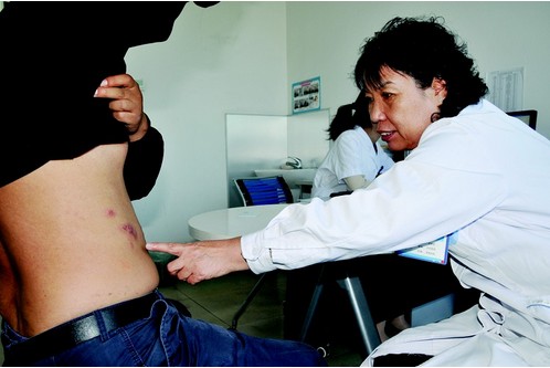 为什么年轻人也会得“带状疱疹”？