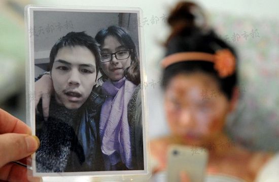 21岁女大学生自幼丧母 遭患精神病弟弟开水淋头