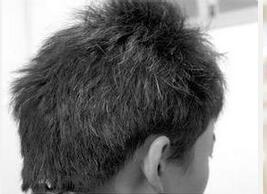 头发颜色可知健康状况 少白头是肾气不足