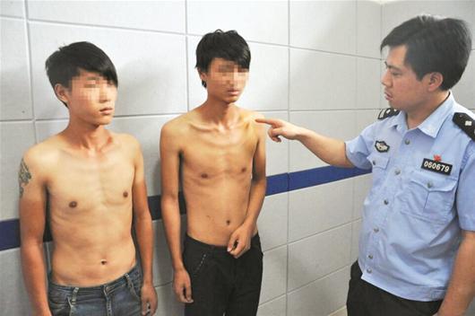 两青年被人砸断锁骨去碰瓷 背后团伙作案30余起