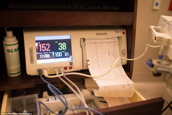 只有在做各种检查的时候，罗宾逊才能够拍些照片。这是她和丈夫的第二个孩子，他们的大儿子今年已经九岁了。为了生第二个宝宝，他们花费了很多精力，还曾经经受过了两次流产，夫妇二人一度想放弃。