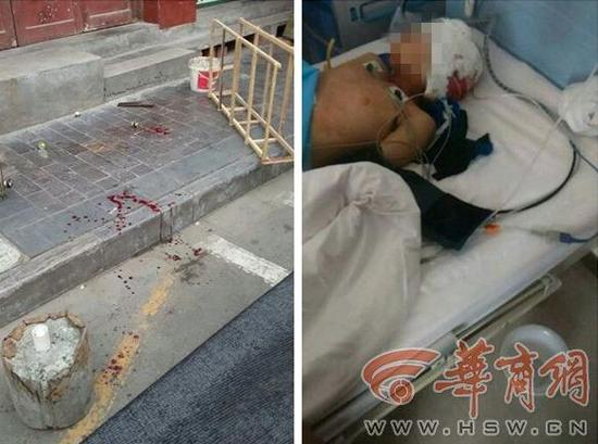 8岁男童家门前被女邻居砍伤 光膀大爷挺身夺刀