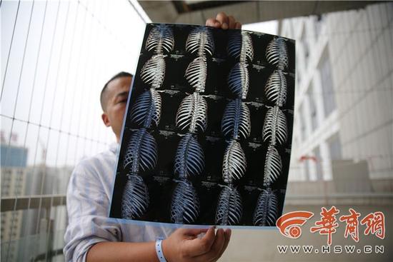 陕西一业主埋怨轿车堵门 被车主打断肋骨