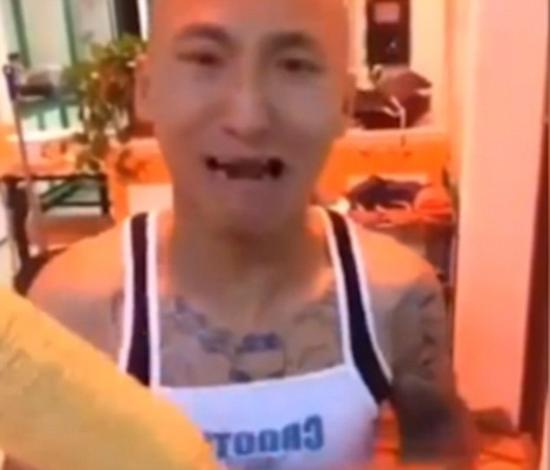 男子表示从来没想到会是这个结果的，看到自己上下门牙掉光后几乎处于崩溃边缘。