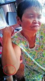 老人称摔倒后其肘部、腿部多处擦伤