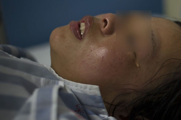 女孩被母亲男友砍伤 身中10多刀两条手筋被砍断2