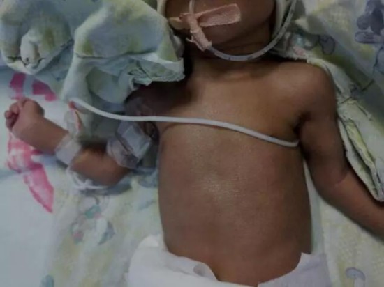 夫妻生下非洲宝宝