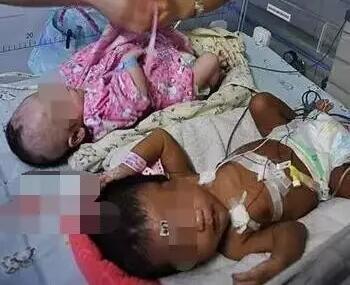 夫妻生下非洲宝宝3