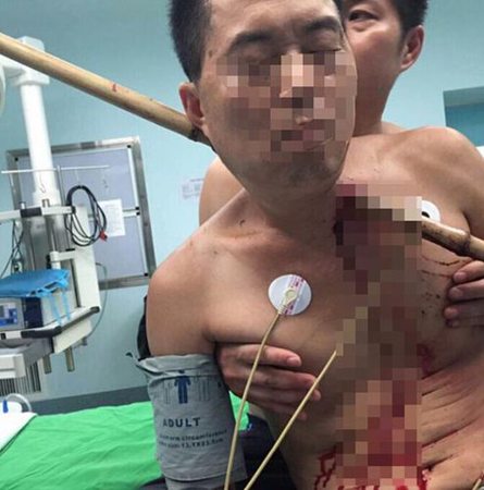 伤者接受紧急处理