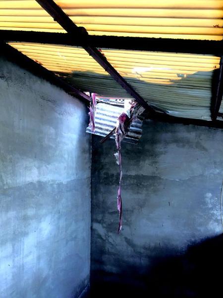 7岁女孩三楼坠下致骨折 家长称其遭玩伴推下