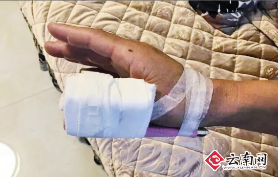 网曝老师帮女儿发小广告被小区保安群殴手指骨折物管：是他自己摔倒