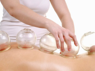 中医拔罐