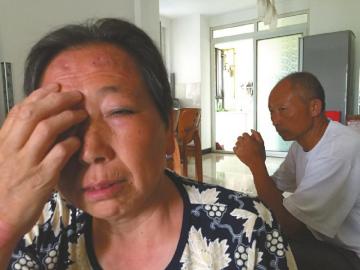 薛英右眼失去了视力，全家一筹莫展。