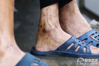 家人给老人脚上栓铁链