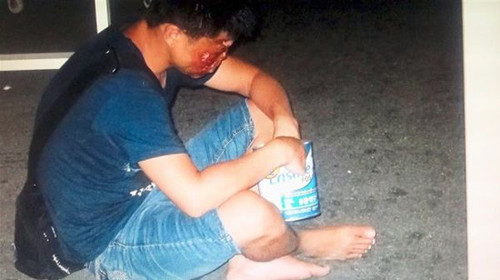 马来西亚《星报》10月17日揭露跨国犯罪团伙在中国拐骗儿童的消息称，犯罪团伙将拐来的儿童弄残、毁容并囚禁多年，再带到马来西亚各景点行乞。据报道，犯罪团伙让行乞者持旅游签证入境马来西亚，到各个旅游景点行乞，并将大部分“收入”上缴团伙头目。