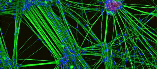 本次大赛获奖作品还包括65颗浮游动物化石、人类皮肤神经元、龙虱前足、蜈蚣的尖牙、碘酸融化的气泡等。