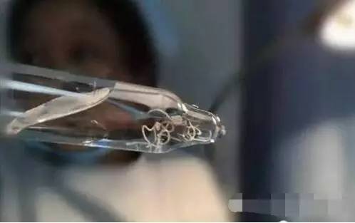 老人眼睛长出虫子