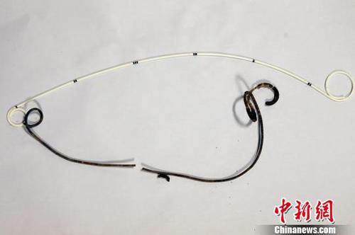 从成先生体内取出的导管，已变成黑色?！≈有?摄