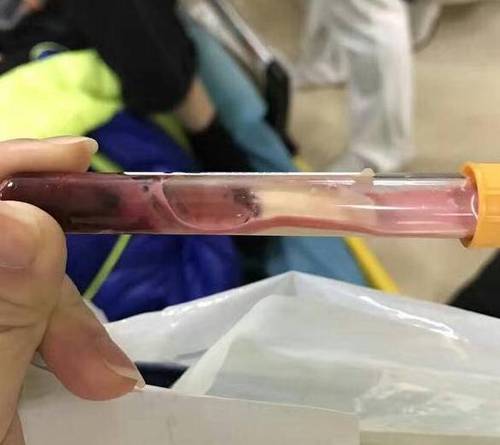 16岁少年生命即将终止 根源竟是父母无原则的溺爱