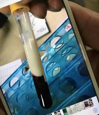 16岁少年生命即将终止 根源竟是父母无原则的溺爱