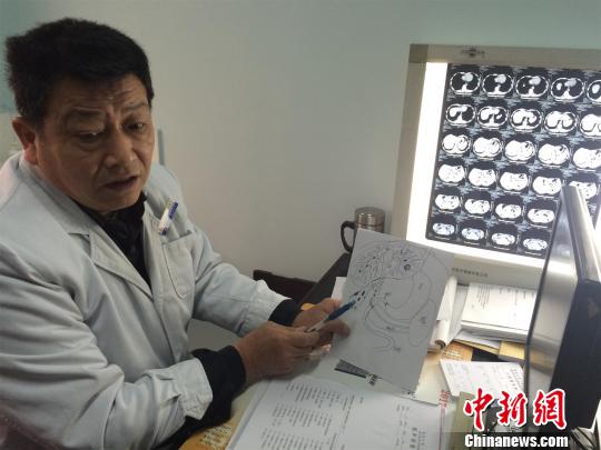湖北一医生“绘图说病”42年助患者了解病情