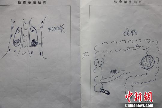 聂继光绘就的病情图纸 龚波 摄