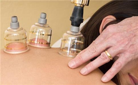 拔罐要注意什么 拔罐有哪些注意事项 拔火罐要注意什么问题