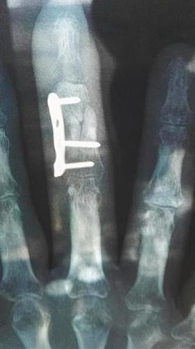 点击进入下一页