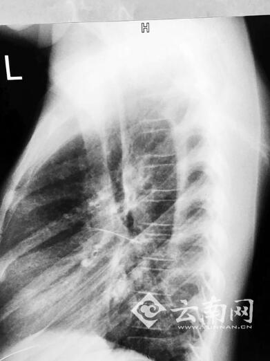点击进入下一页
