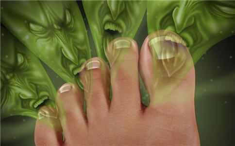 脚气怎么根治 怎么可以治疗脚气 引起脚气的原因是什么